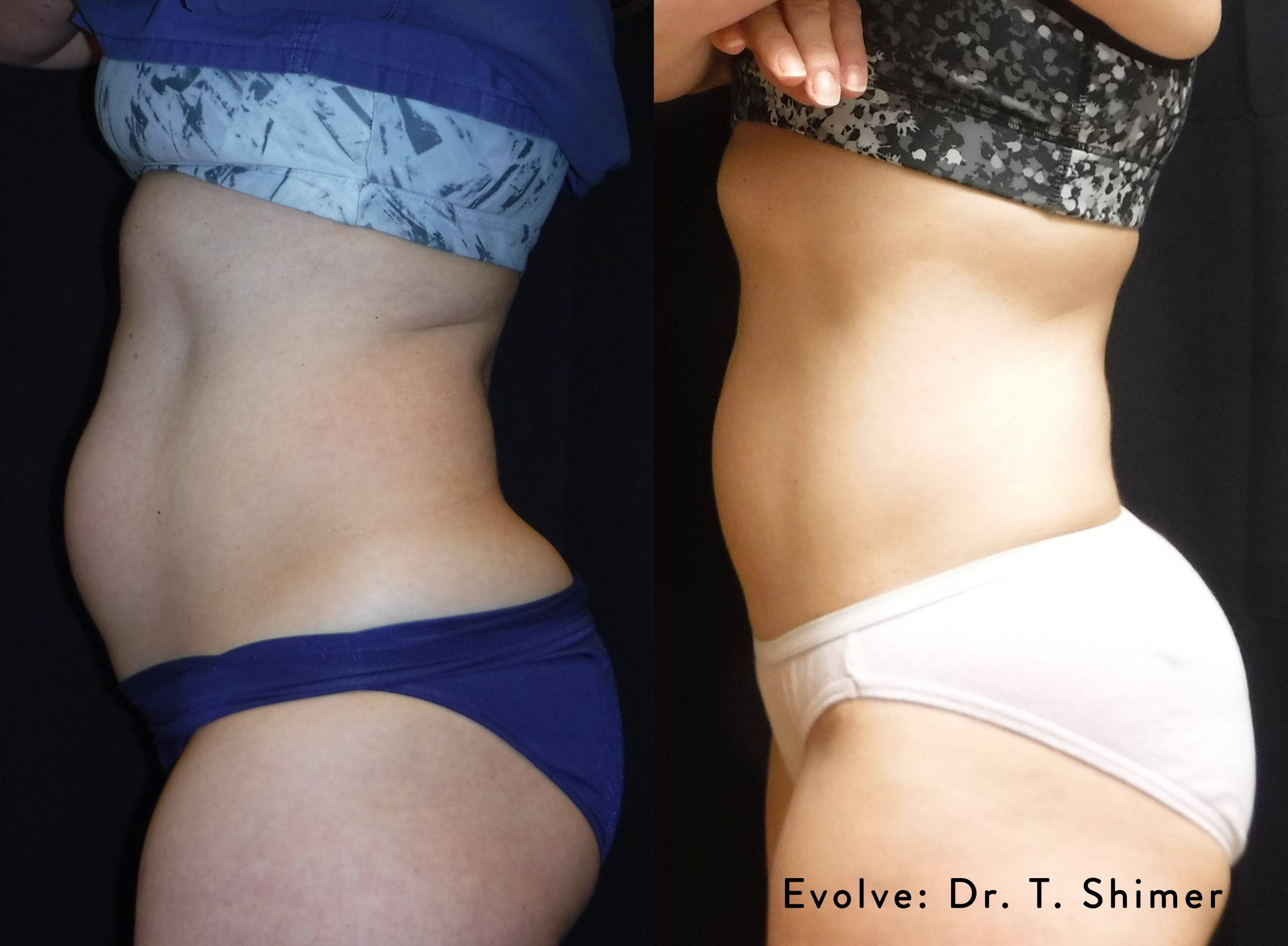 evolve-before-after-01