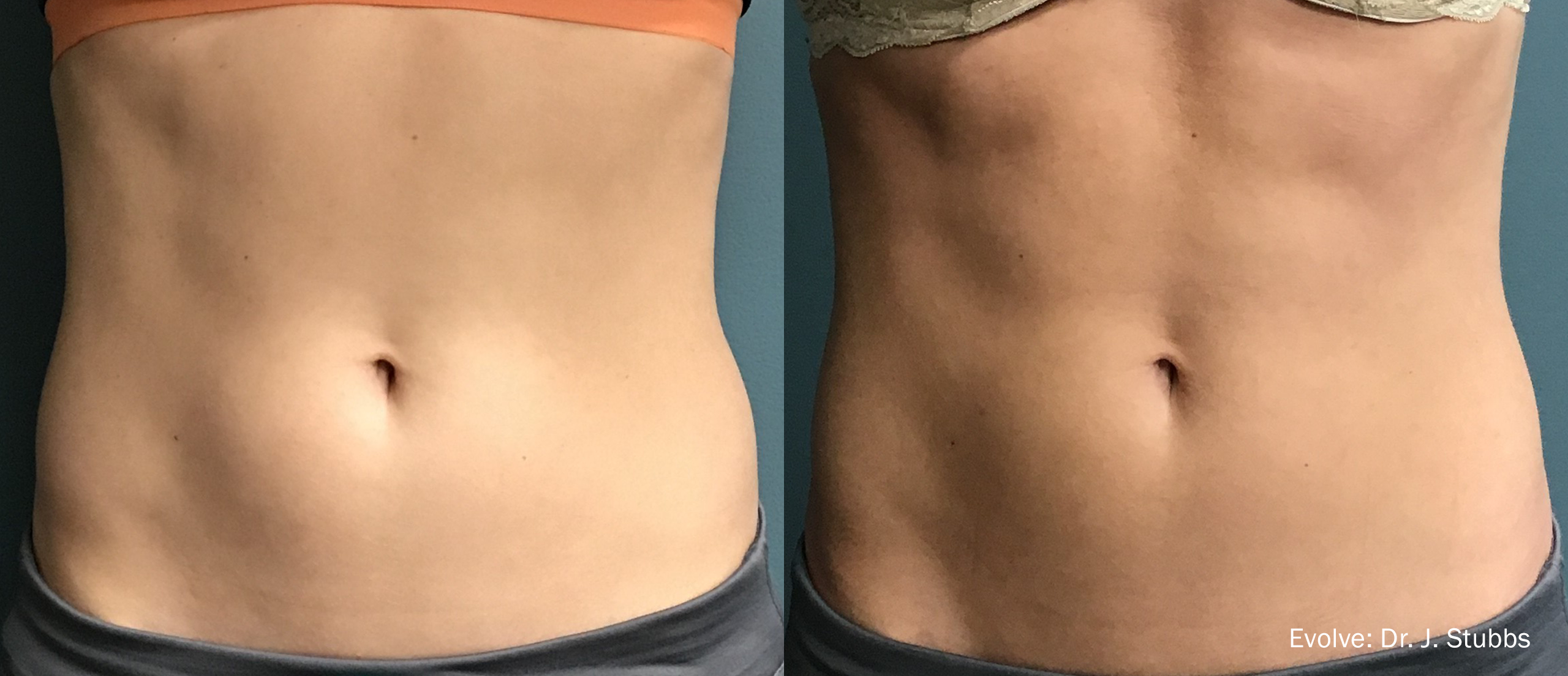 evolve-before-after03